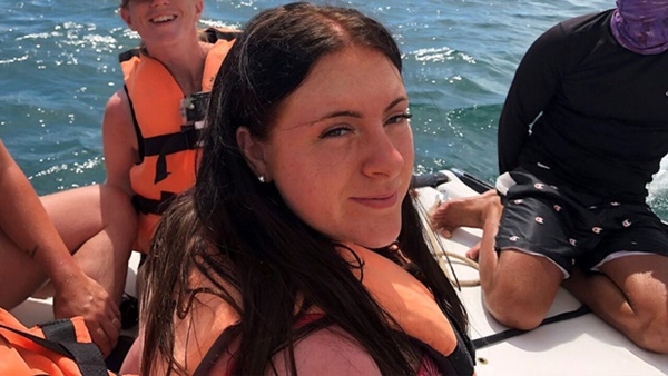 Cô gái 16 tuổi bị bỏng nắng nghiêm trọng, khiến vùng lưng nổi đầy mụn nước siêu to khổng lồ-1