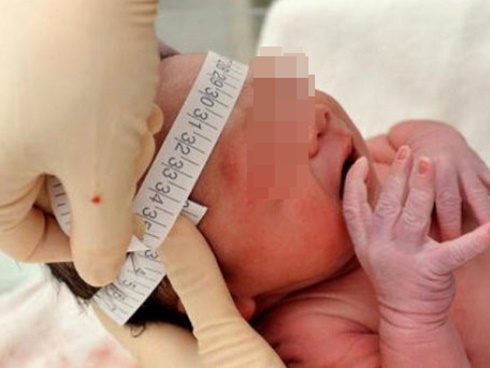 Cô dâu đột tử vì chú rể hôn quá mãnh liệt, 4 điểm trên cơ thể tránh tác động mạnh-5