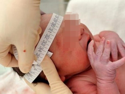 Bé 5 tháng tuổi nôn liên tiếp 2 ngày, vòng đầu to thấy rõ, có nguy cơ tử đột tử vì mắc căn bệnh này
