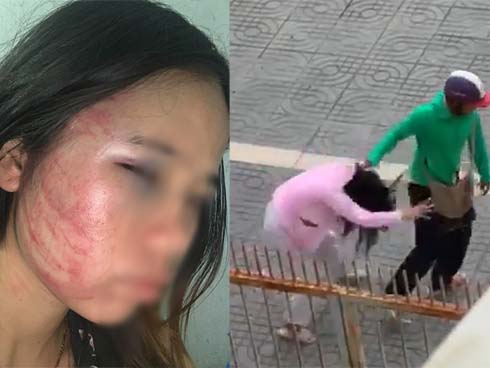 Bắt U70 tống tiền người tình bằng clip nóng-2