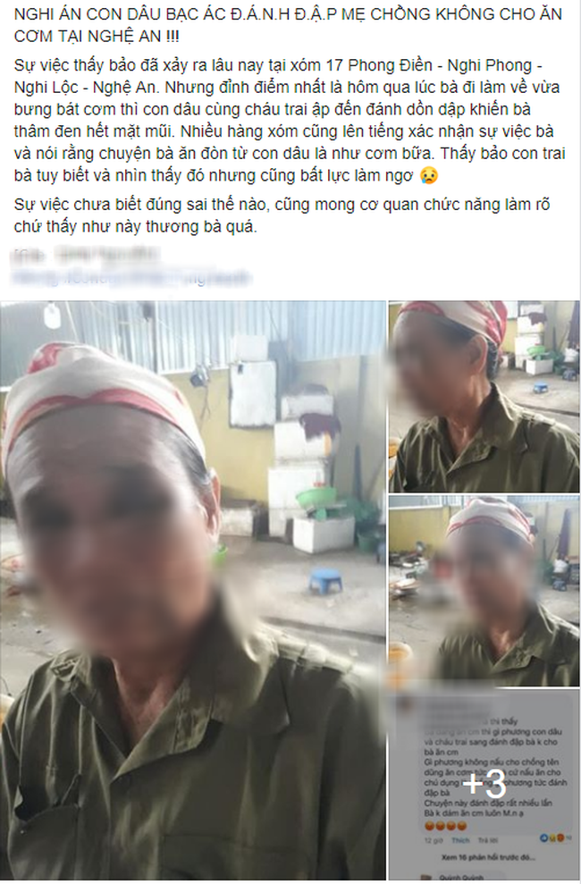 Nghi án con trai làm ngơ để vợ ngược đãi mẹ ruột, đánh mẹ bầm tím mặt rồi không cho ăn cơm-1