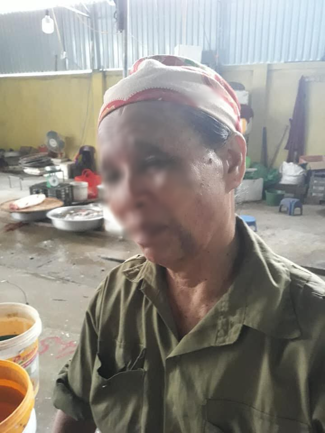 Nghi án con trai làm ngơ để vợ ngược đãi mẹ ruột, đánh mẹ bầm tím mặt rồi không cho ăn cơm-2