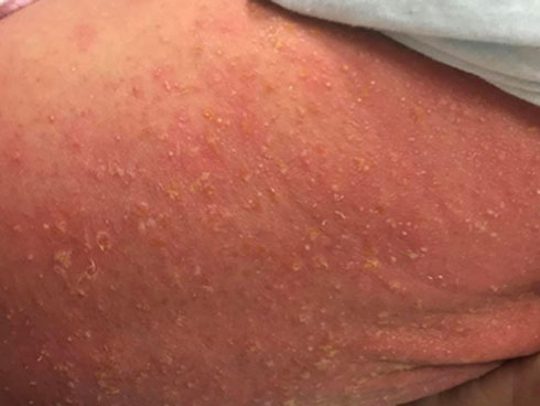 Cảnh báo dùng rượu gừng nghệ hạ thổ làm đẹp cho phụ nữ sau sinh-4