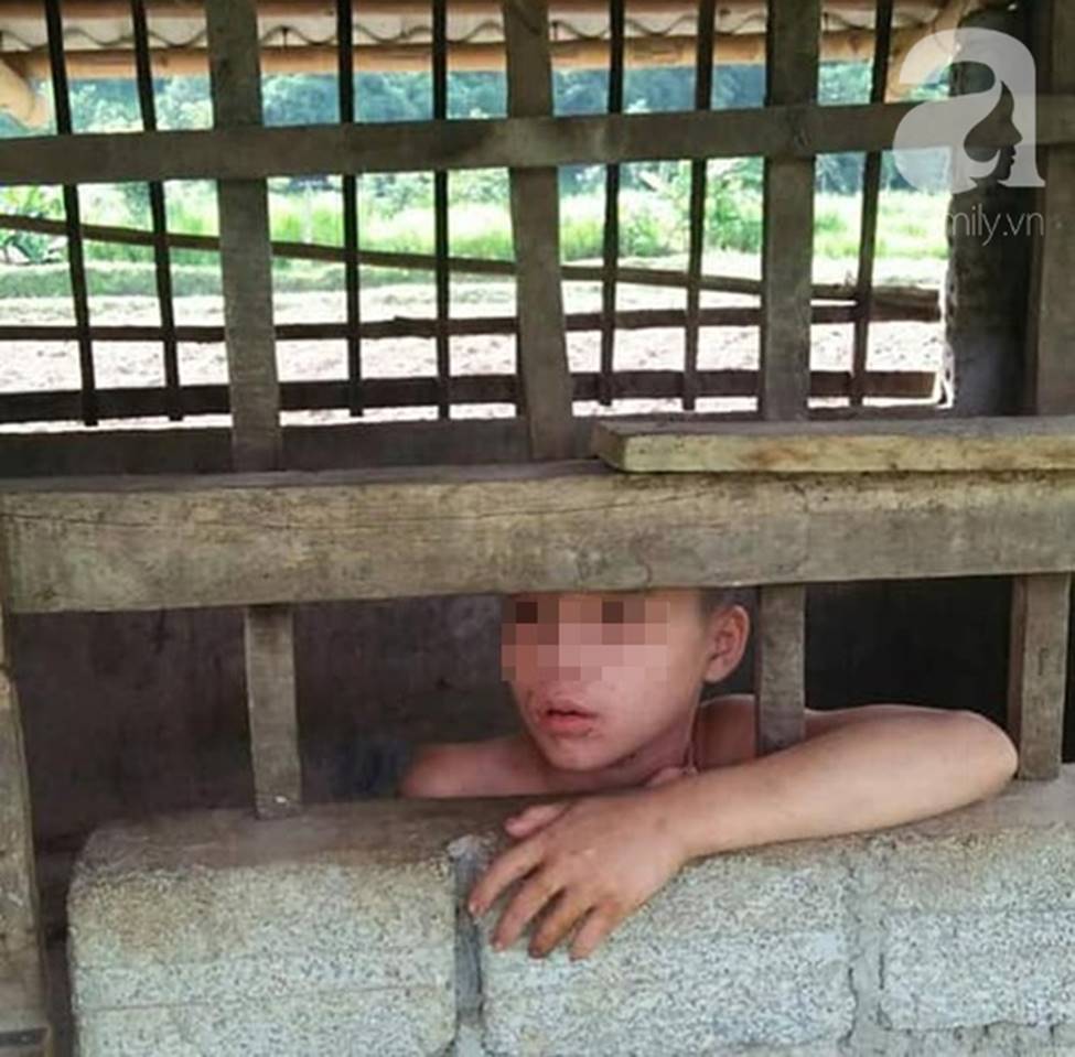 Đằng sau bức ảnh bé trai 13 tuổi trần truồng, bị ông nội cột dây, nhốt trong chuồng là một câu chuyện đầy thương cảm-1