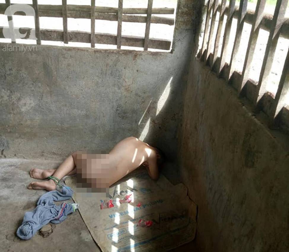 Đằng sau bức ảnh bé trai 13 tuổi trần truồng, bị ông nội cột dây, nhốt trong chuồng là một câu chuyện đầy thương cảm-3