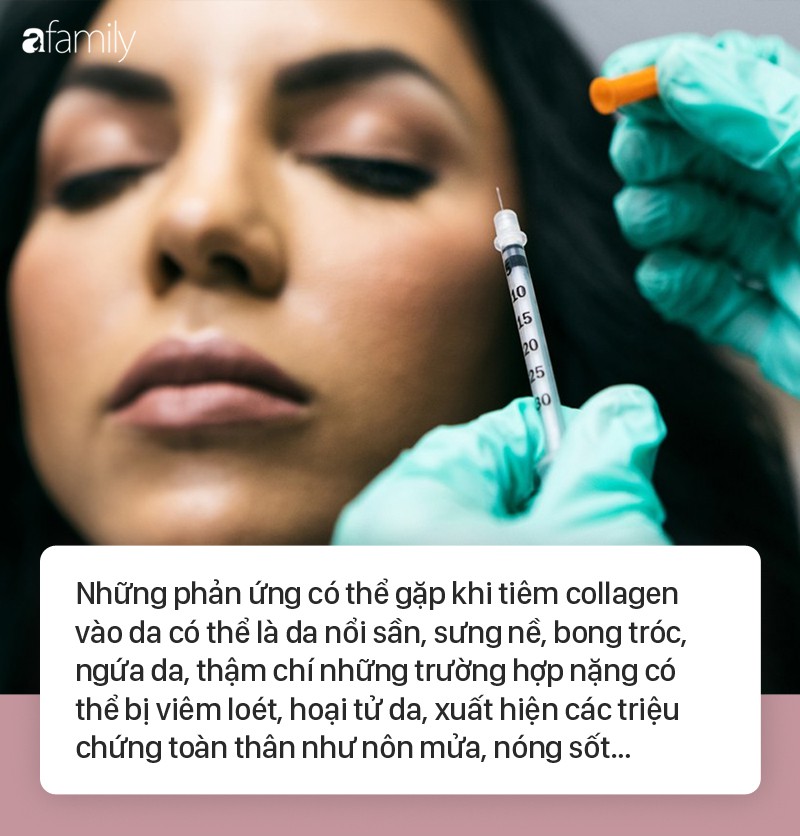 Tiêm collagen làm đẹp da, làn da người phụ nữ nổi sần khắp mặt phải cầu cứu bác sĩ-3