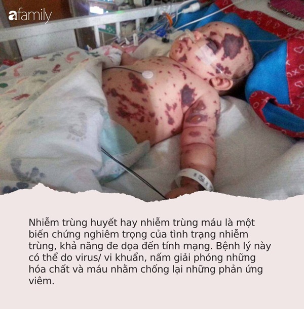 Bệnh nhiễm trùng giết chết 5.000 người Úc mỗi năm, ở Việt Nam cũng có: Đây là cách phát hiện sớm nhất để tự cứu mình-1