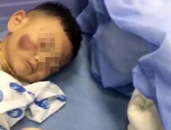 Bé 2 tuổi có thể phải sống thực vật vì nghi bị mẹ kế bạo hành-1