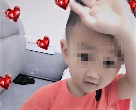 Bé 2 tuổi có thể phải sống thực vật vì nghi bị mẹ kế bạo hành-2