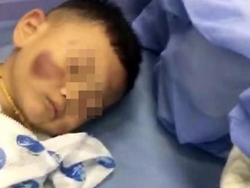 Chuyện cổ tích bạn trai tận tụy chăm sóc bạn gái sống thực vật suốt 2 năm cảm động lòng người nhưng sự thật lại gây căm phẫn tột độ-6