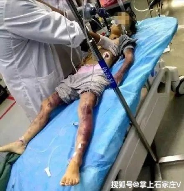 Bị cha bạo hành tới chết, câu nói cuối cùng của cô bé 6 tuổi khiến ai cũng nhói lòng-1