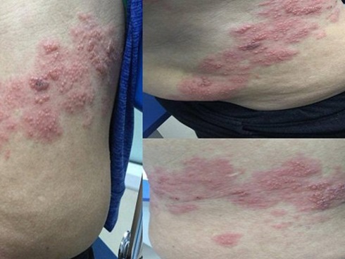 Em bé Ấn Độ chào đời với 4 chân và 3 tay-1