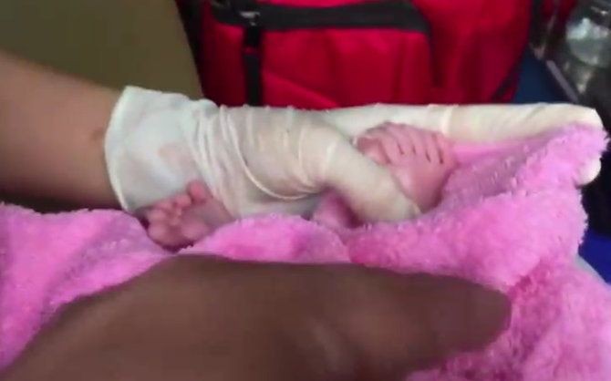Thai phụ chuyển dạ sinh con ngay trên đường đến bệnh viện, bác sĩ đỡ đẻ nhìn tay chân đứa bé bỗng giật mình không nói được gì-2