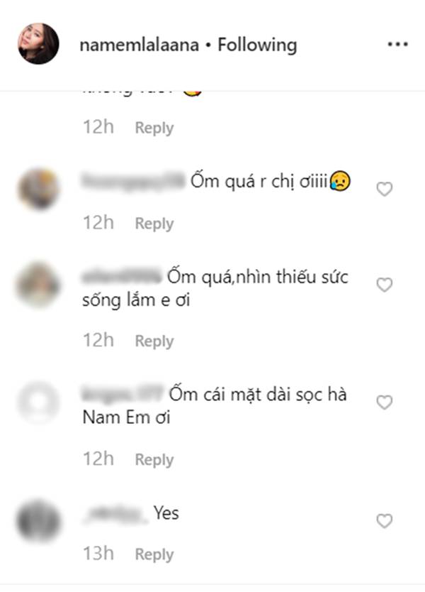 Hết hồn với gương mặt Nam Em, giảm cân thế này thì giảm làm gì?-3