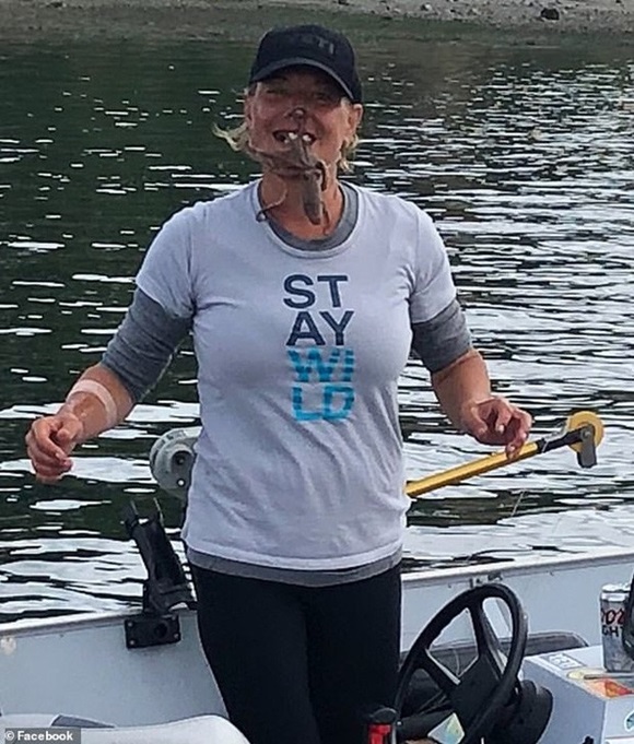 Chụp ảnh sống ảo với bạch tuộc, chị ngư dân bị cắn 2 phát đầy uy lực khiến khuôn mặt chảy máu và sưng tấy suốt 2 tháng-1