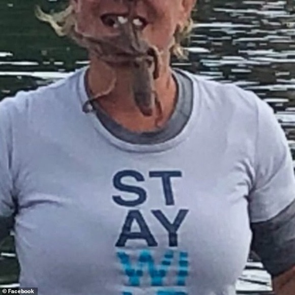 Chụp ảnh sống ảo với bạch tuộc, chị ngư dân bị cắn 2 phát đầy uy lực khiến khuôn mặt chảy máu và sưng tấy suốt 2 tháng-2