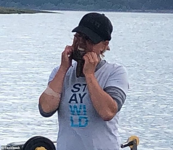 Chụp ảnh sống ảo với bạch tuộc, chị ngư dân bị cắn 2 phát đầy uy lực khiến khuôn mặt chảy máu và sưng tấy suốt 2 tháng-3