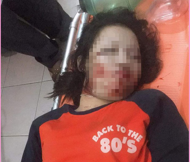 Truy tìm chiếc xe tải đâm trúng đường dây điện khiến nữ sinh 17 tuổi tử vong-2