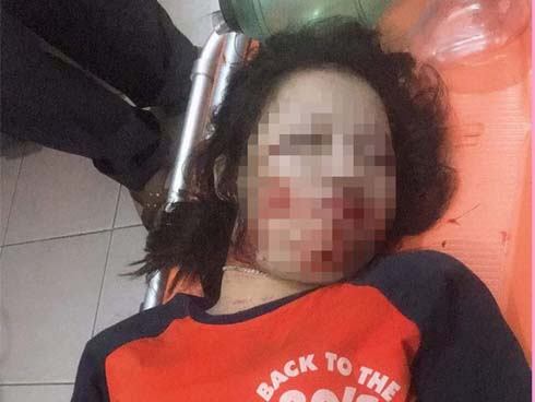 Trời mưa lớn khiến cây xanh ngã đổ, một nam thanh niên tử vong khi di chuyển trên đường-8