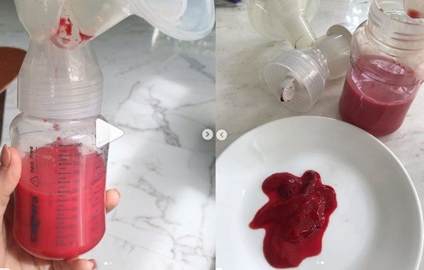 Khoe bình sữa nóng hổi vừa vắt, nữ diễn viên được dân mạng khuyên gặp bác sĩ gấp-3