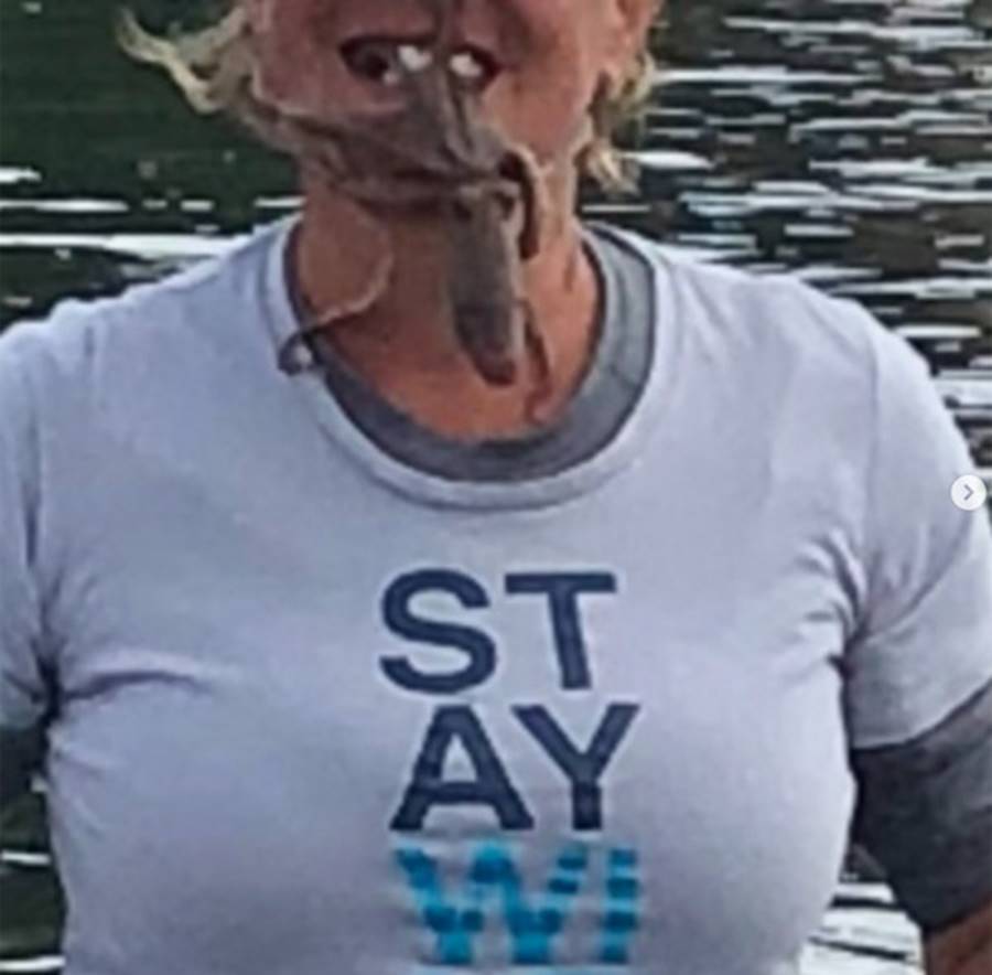 Đặt bạch tuộc lên mặt chụp ảnh sống ảo, người phụ nữ bị cắn đẫm máu, tê liệt cả cánh tay-1