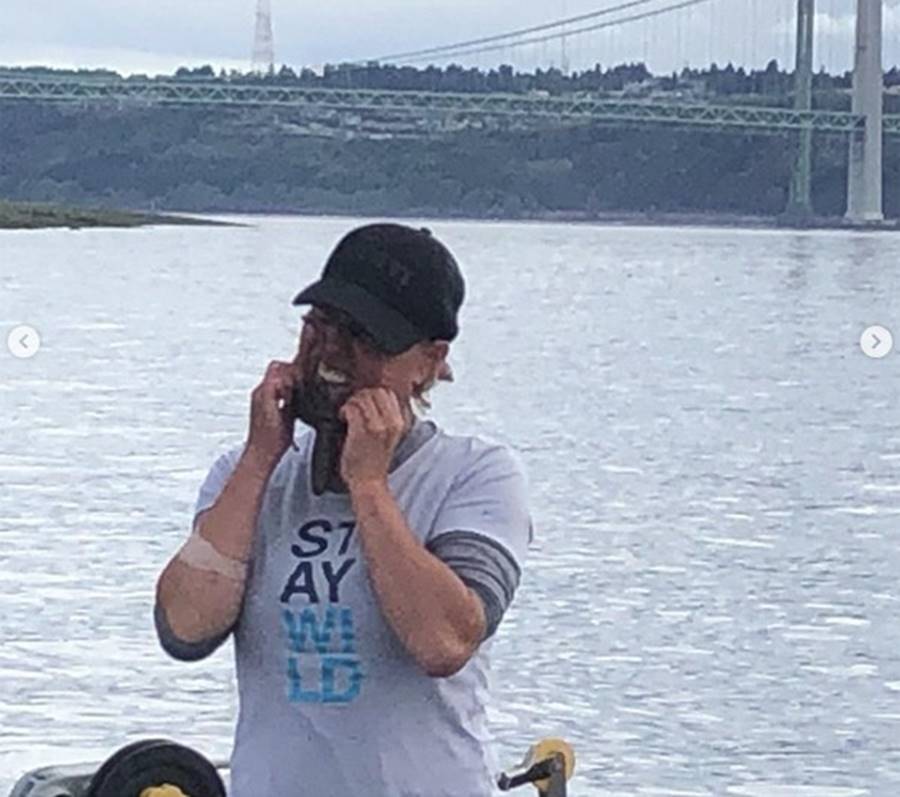 Đặt bạch tuộc lên mặt chụp ảnh sống ảo, người phụ nữ bị cắn đẫm máu, tê liệt cả cánh tay-2