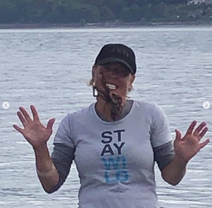 Đặt bạch tuộc lên mặt chụp ảnh sống ảo, người phụ nữ bị cắn đẫm máu, tê liệt cả cánh tay-3