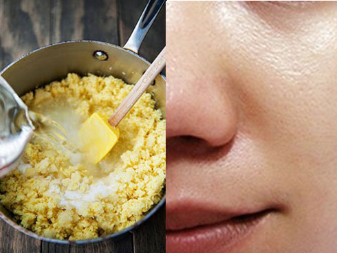 Tuyệt đối không được làm những điều sau, da mặt sẽ xấu đi vì sẹo rỗ-5