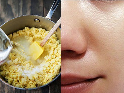 Trị mụn, nám, sẹo thâm, lại còn giảm cân hiệu quả, củ gừng 2000 đồng thật nhiều công dụng!