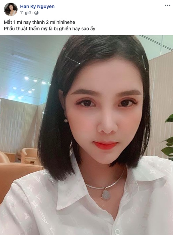 Đang háo hức khoe nghiện phẫu thuật thẩm mỹ, Kỳ Hân bị chê bai chưa bằng một phần người yêu cũ của chồng ngay tức khắc-1