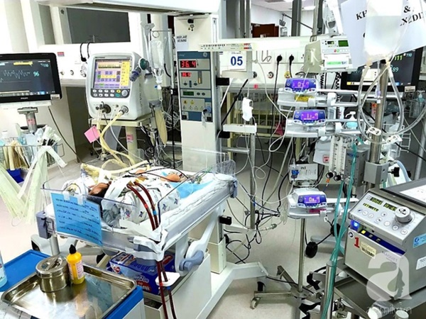 Bé trai 1 ngày tuổi bị suy hô hấp nặng, viêm phổi vì hít phải phân su trong bụng mẹ: Bác sĩ cảnh báo sản phụ lưu ý ngay điều này-1