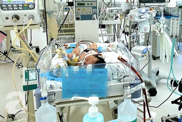 Bé trai 1 ngày tuổi bị suy hô hấp nặng, viêm phổi vì hít phải phân su trong bụng mẹ: Bác sĩ cảnh báo sản phụ lưu ý ngay điều này-3