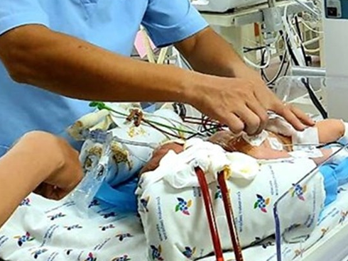 Bé trai 1 ngày tuổi bị suy hô hấp nặng, viêm phổi vì hít phải phân su trong bụng mẹ: Bác sĩ cảnh báo sản phụ lưu ý ngay điều này