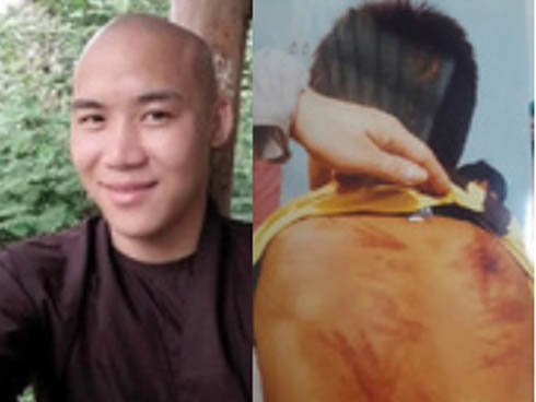 Vụ thầy giáo trẻ bị bắt vì dâm ô học sinh: 5 học sinh tiểu học bị thầy hành xử đồi bại-1