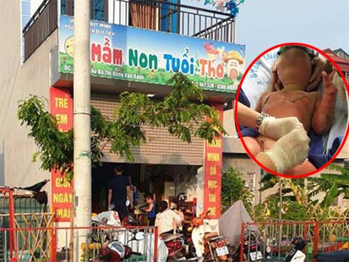 Cô giáo dạy kỹ năng sống làm 3 trẻ bị bỏng: Tôi không có tâm trạng để nói lại”-3