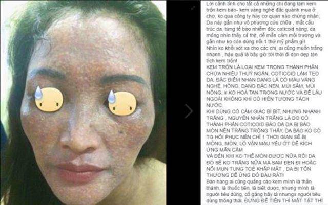 Mục sở thị” thị trường kem trộn: Hot girl đổ xô đi bán kem - Hậu quả người mua gánh-12