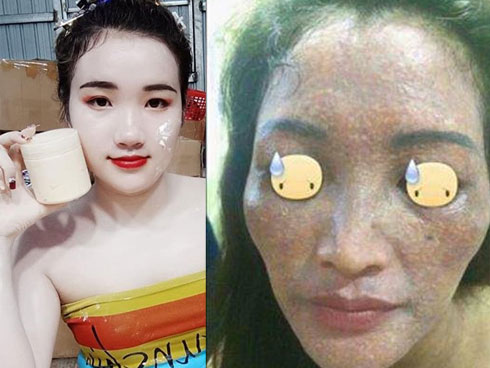 Hết kem trộn lại đến son trộn được rao bán tràn lan trên MXH: Kinh hãi với những tác hại khôn lường khi đôi môi bị tẩm” đầy hóa chất độc hại!-7