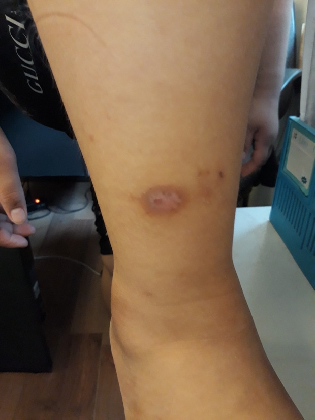 Nghi án bố cùng dì ghẻ bạo hành con trai dã man suốt nhiều năm ở Phú Thọ: Đốt túi bóng nhỏ vào mông, bắt nhặt cơm dưới đất lên ăn-4