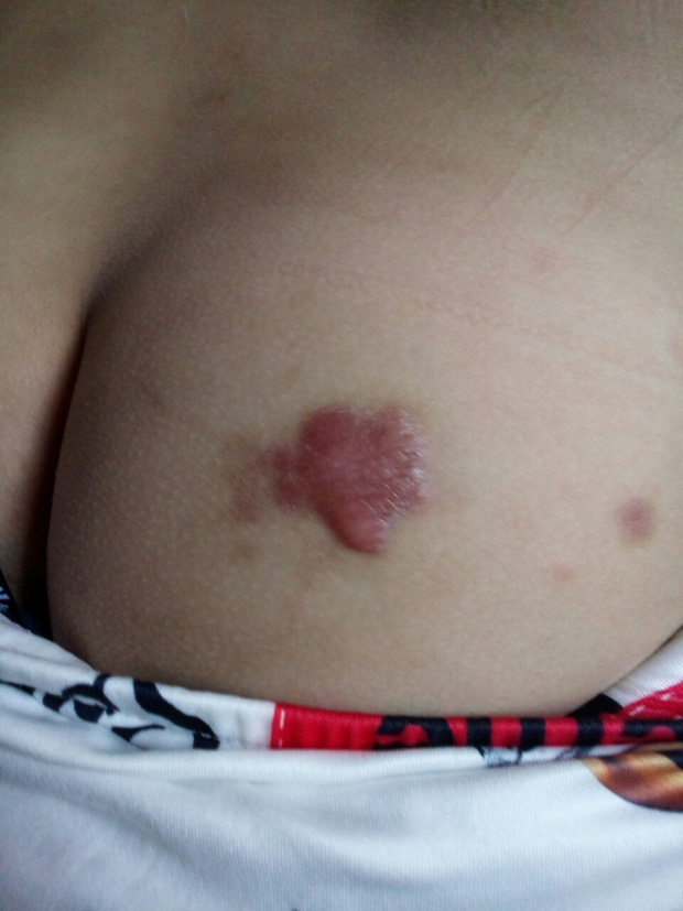 Nghi án bố cùng dì ghẻ bạo hành con trai dã man suốt nhiều năm ở Phú Thọ: Đốt túi bóng nhỏ vào mông, bắt nhặt cơm dưới đất lên ăn-5