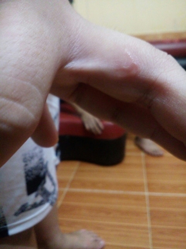 Nghi án bố cùng dì ghẻ bạo hành con trai dã man suốt nhiều năm ở Phú Thọ: Đốt túi bóng nhỏ vào mông, bắt nhặt cơm dưới đất lên ăn-8