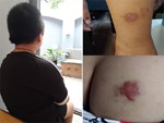 Mẹ bé trai 12 tuổi nghi bị bố ruột, mẹ kế bạo hành: Thằng bé khóc lóc cầu xin tôi cứu nó nếu không sẽ tự tử-6