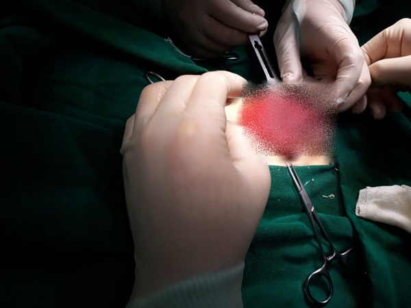 Bé sơ sinh 6 ngày tuổi bị xoắn ruột, hoại tử buồng trứng: Cha mẹ cần phát hiện sớm nếu thấy con có dấu hiệu này-1