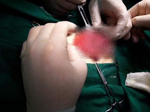 Người mẹ bị xuất huyết buồng trứng nghiêm trọng phải cắt bỏ, hối hận vì để con trai nghịch ngợm-2