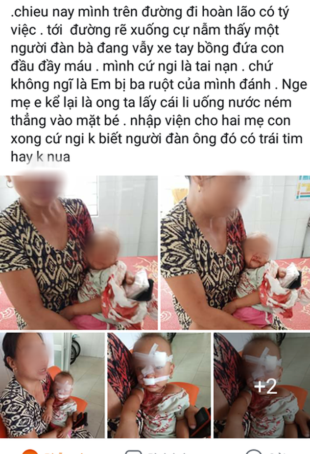 NÓNG: Bé gái 2 tuổi mặt mũi đầy máu được mẹ bế đi cấp cứu, nghi do bố ruột bạo hành-1