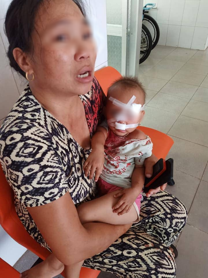 NÓNG: Bé gái 2 tuổi mặt mũi đầy máu được mẹ bế đi cấp cứu, nghi do bố ruột bạo hành-4