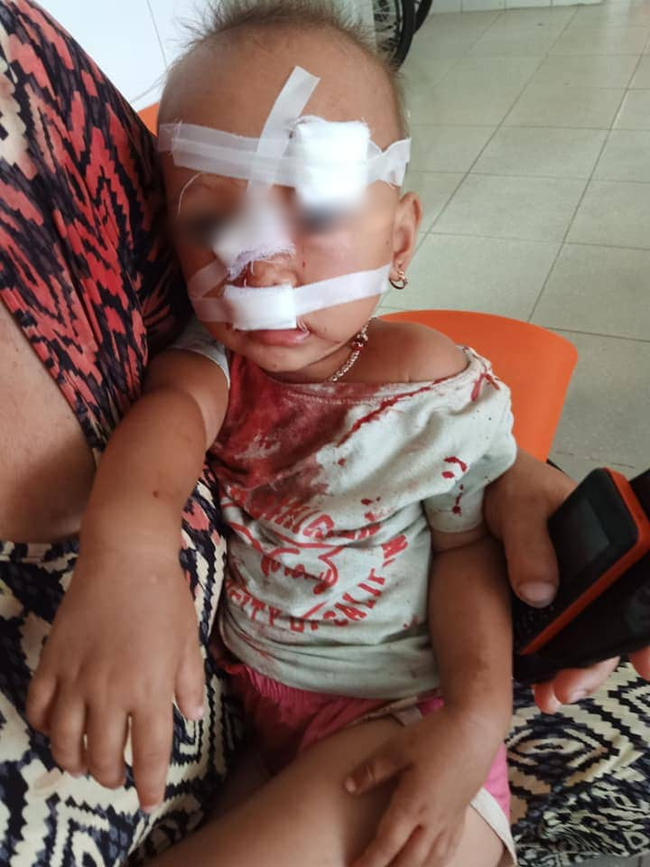 NÓNG: Bé gái 2 tuổi mặt mũi đầy máu được mẹ bế đi cấp cứu, nghi do bố ruột bạo hành-5