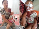 Mẹ bé gái bị cha ruột ném ly vào mặt, khâu 12 mũi: Lúc 13 tháng, con bé cũng bị ném vật cứng làm chấn thương sọ não-4
