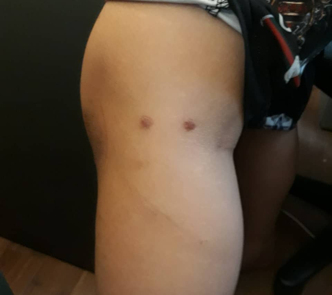 Mẹ bé trai 12 tuổi nghi bị bố ruột, mẹ kế bạo hành: Thằng bé khóc lóc cầu xin tôi cứu nó nếu không sẽ tự tử-3