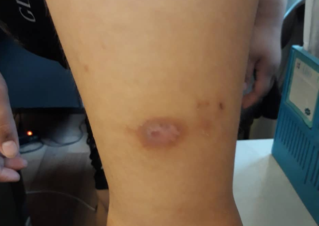 Mẹ bé trai 12 tuổi nghi bị bố ruột, mẹ kế bạo hành: Thằng bé khóc lóc cầu xin tôi cứu nó nếu không sẽ tự tử-5