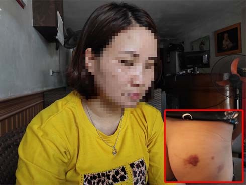 Mẹ bé trai 12 tuổi nghi bị bố ruột, mẹ kế bạo hành: 